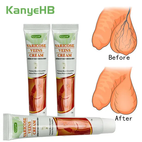 crèmes pour varices génitales Pack 2 Piéce