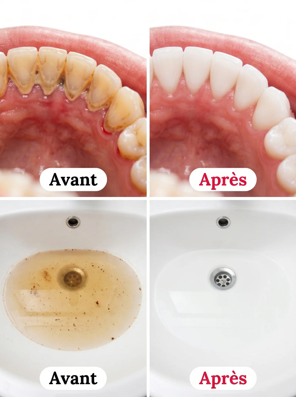 Bain de bouche détachant Boundary - Nettoyage en profondeur, saveur menthe longue durée